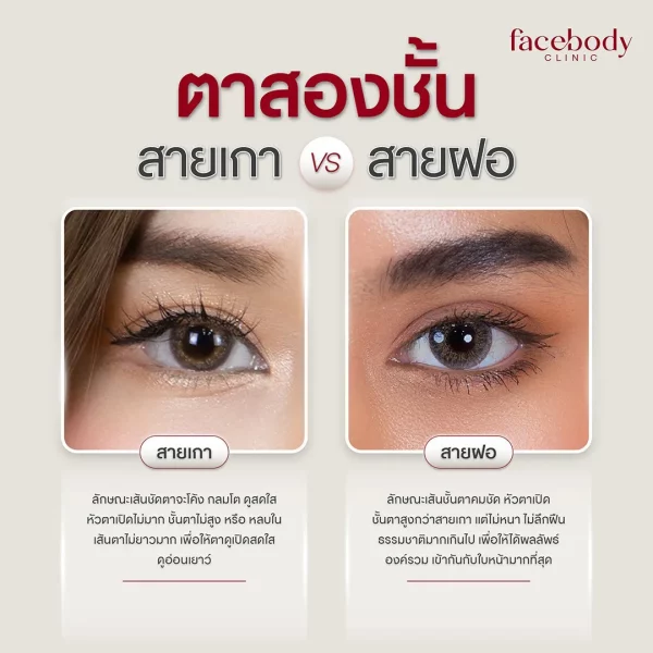 ทำตา 2 ชั้น ทำตา 2 ชั้น