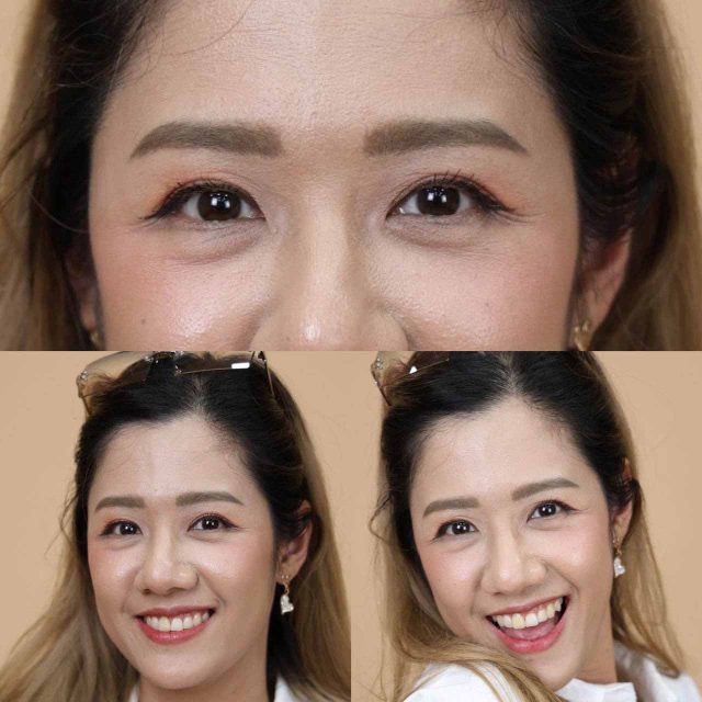 รีวิวทำตาสองชั้น คุณจูน 3 รีวิวทำตาสองชั้น คุณจูน 3