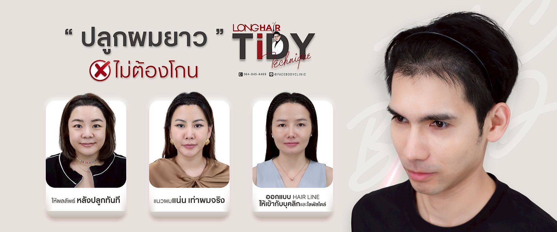ทำตาสองชั้น ทรงไหนดี หมอธีร์มีคำตอบ เข้ามาปรึกษาทีมแพทย์ชั้นนำของเรา เพื่อเนรมิตตาสองชั้นที่สวยธรรมชาติ