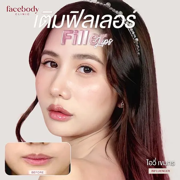 ทำตาสองชั้น ปลูกผม ยกคิ้ว ฟิลเลอร์