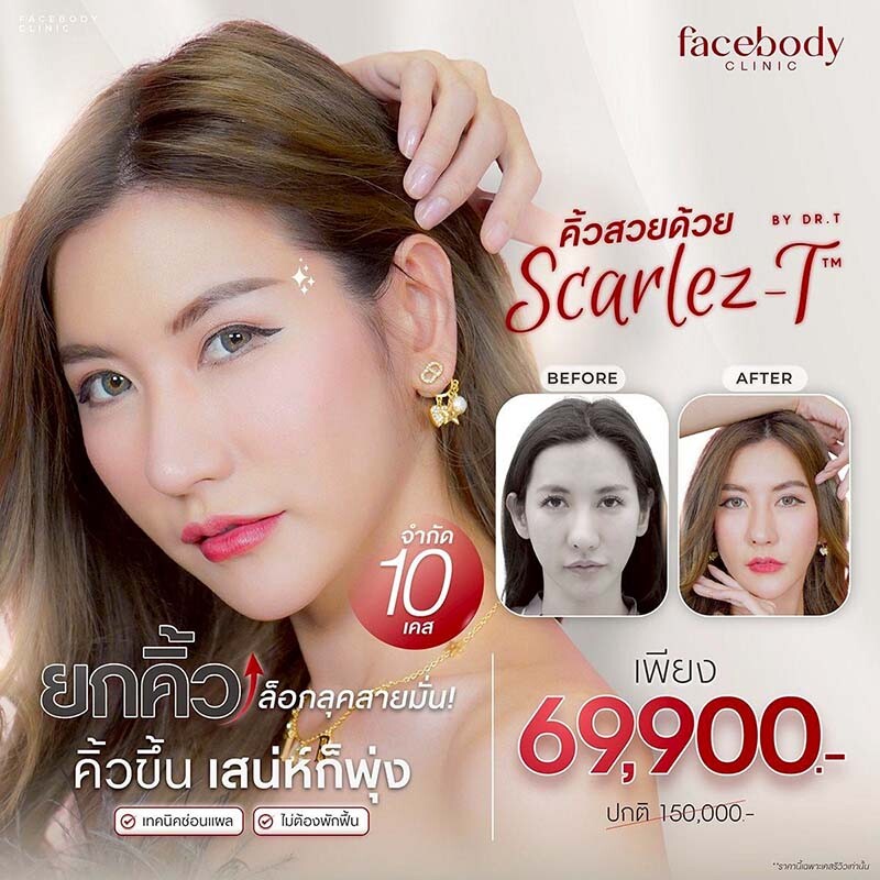 ศัลยกรรมยกคิ้ว : รากฐานแห่งความงาม 